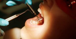 A Regular Dental Visit Is Important for These Reasons